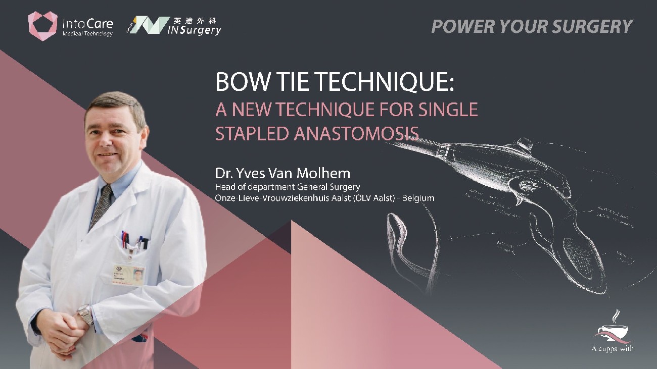 BOW TIE TECHNIQUE: A NEW TECHNIQUE FOR SINGLE STAPLED ANASTOMOSIS